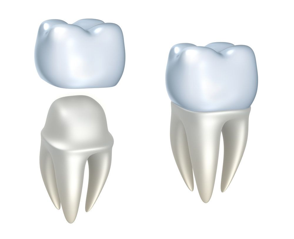<p>Dental crowns and tooth, isolated on white.</p>